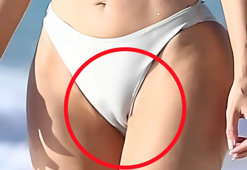 How to get rid of bikini camel toe