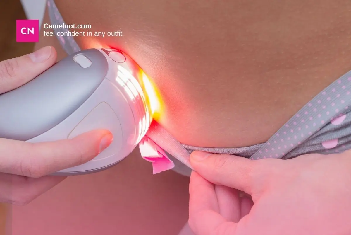 Can Camel Toes Be Trimmed?