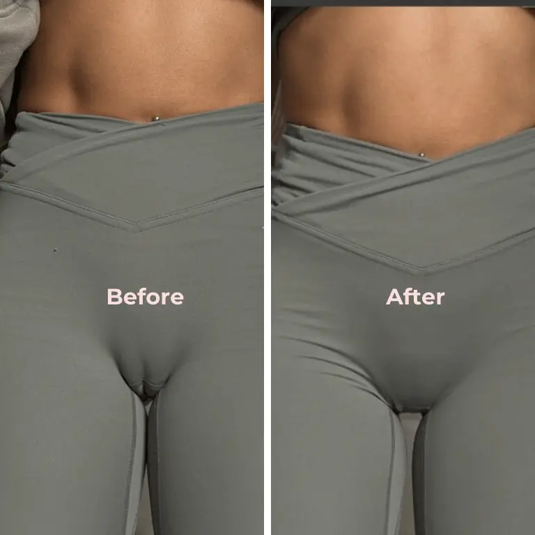 Before and After Camelnot